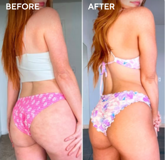 <p><strong>Why Women Are Obsessed</strong></p>